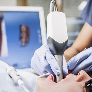 dental crown process