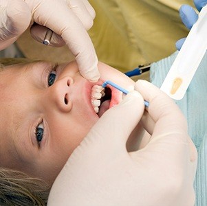 kid getting fluoride treatment