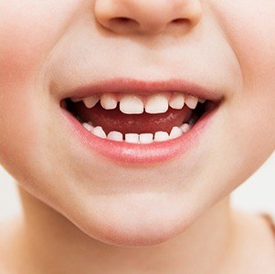 close up of child's smile
