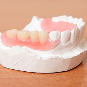 partial denture