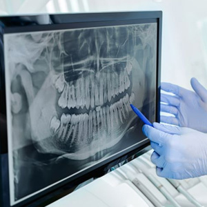 Dentist using a pen to point something out on X-ray