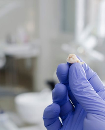Gloved hand holding an extracted tooth