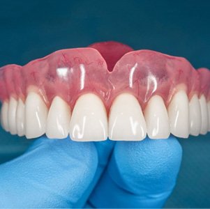 Gloved hand holding denture for upper arch