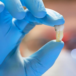Close-up of gloved hand holding extracted tooth