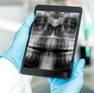 x-ray on tablet